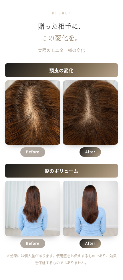  S-Lab 美容液自動滴下 LEDスカルプ・ヘアブラシ｜EMS 赤色光LED 振動マッサージ 4役 頭皮ケア 抜け毛 薄毛 ボリューム ハリ ツヤ髪 スカルプケア ヘッドスパ 自宅エステ 美容家電 誕生日プレゼント 彼氏 夫 父 母 彼女 妻 記念日 クリスマス ギフト 結婚記念日　サプライズ　喜ばれる　男性へ　女性へ　20代　30代　40代 50代　贈り物　高級　プチ贅沢　特別 もらって嬉しい