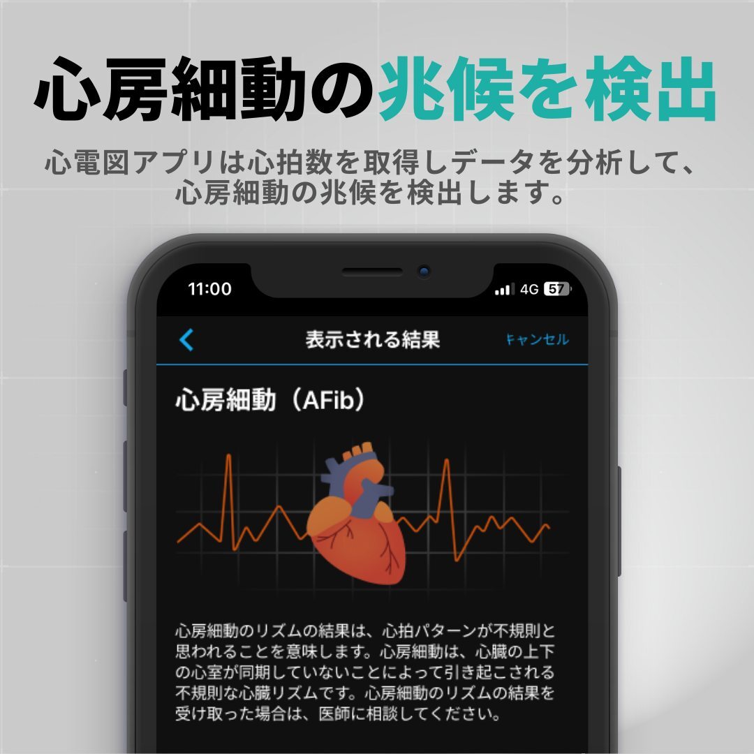 GPSスマートウォッチ ガーミン GARMIN Venu 4 41mm 【取説サービス】 心電図 Suica対応 通知機能 通話発信・応答 音声操作 音楽保存・再生 血中酸素 スポーツウォッチ ダイエット ランニング ジョギング 筋トレ ゴルフ 水泳