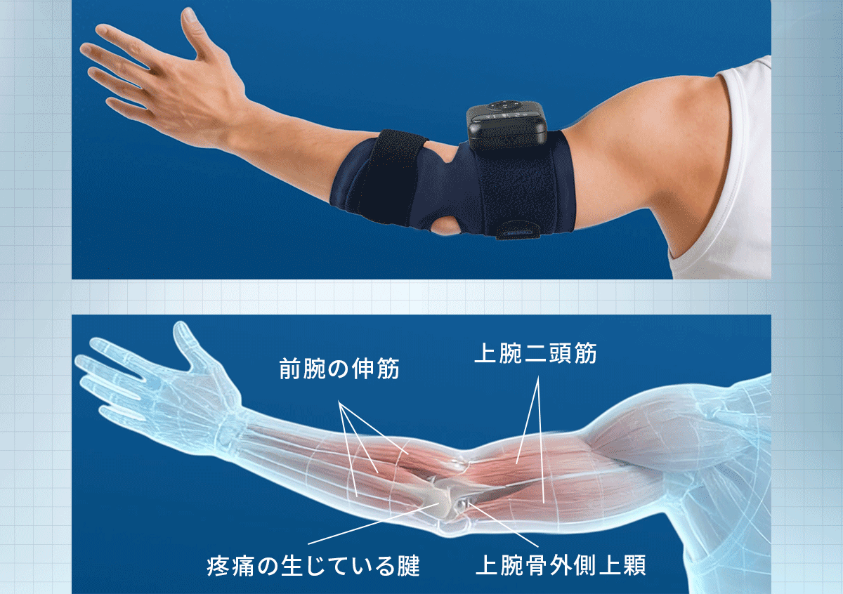 肘サポーター ひじ マッサージ テニス肘 サポーター マッサージャー 育児 家事 パソコン作業 スマホ操作 結婚祝い 健康 グッズ 母の日 プレゼント 人気