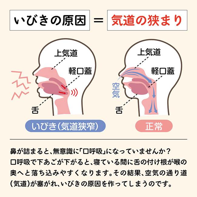 ノン・ノイズ・ノーズ[いびき 鼻呼吸 いびき対策 ノーズクリップ 鼻腔拡張 鼻クリップ いびき防止グッズ 睡眠グッズ ノーズピン 口呼吸対策 快眠グッズ 鼻孔拡張 いびきグッズ 鼻呼吸グッズ 安眠グッズ 鼻腔拡張器 いびきケア]