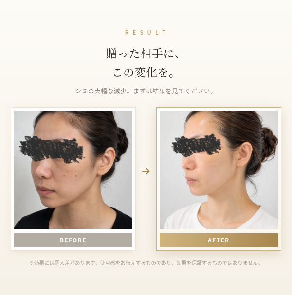 多機能ダーマペン S-LAB Derma｜マイクロニードリング エレクトロポレーション EMS 4役 ニキビ跡 毛穴 小ジワ 美肌 コラーゲン 肌再生 美容家電 自宅エステ クリニック級 30代 誕生日プレゼント 彼女 妻 記念日 クリスマス ギフト 結婚記念日 サプライズ 喜ばれる 女性へ 20代 30代 40代 贈り物 高級 プチ贅沢 特別な日 もらって嬉しい