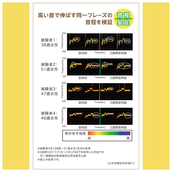 ボイストレーニンググッズ 通販 ウタエット UTAET ボイトレグッズ 消音機能 リアルボイス機能 ブレスリミット機能 カラオケ 練習 声帯 トレーニング 本気 全力 一人カラオケ ひとカラ 腹式呼吸 歌 熱傷 ながらエクササイズ ストレス発散