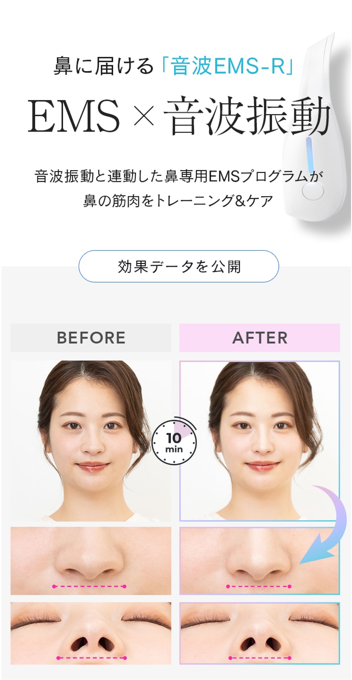 通販王 がっちりマンデー で紹介！正規品 鼻専用 EMS 美顔器 LUXCEAR Fornez 通販王 ルクセア フォーネス ノーズクリップ 鼻 高く ケア EMS 鼻矯正 Eライン 鼻クリップ 鼻プチ 美鼻 ノーズアップピン 鼻高 ヒルナンデス
