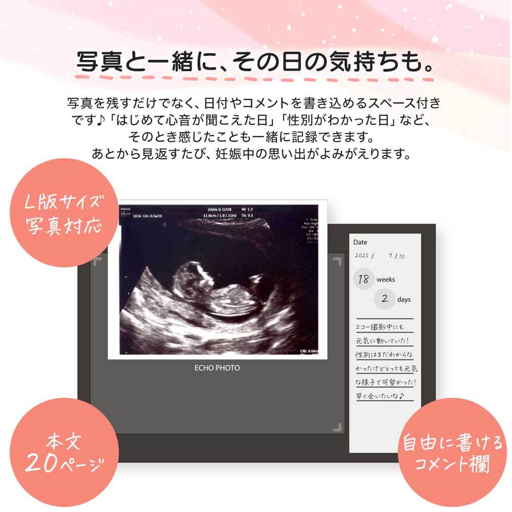エコー写真アルバム &mom アンドマム サンスター文具 選べる3柄 スヌーピー ディズニー ベビーミッキー すみっコぐらし マタニティ アルバム エコーアルバム 母子手帳ケース 妊娠 記録 出産祝い プレゼント 日本製