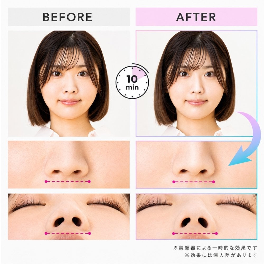 通販王 がっちりマンデー で紹介！正規品 鼻専用 EMS 美顔器 LUXCEAR Fornez 通販王 ルクセア フォーネス ノーズクリップ 鼻 高く ケア EMS 鼻矯正 Eライン 鼻クリップ 鼻プチ 美鼻 ノーズアップピン 鼻高 ヒルナンデス