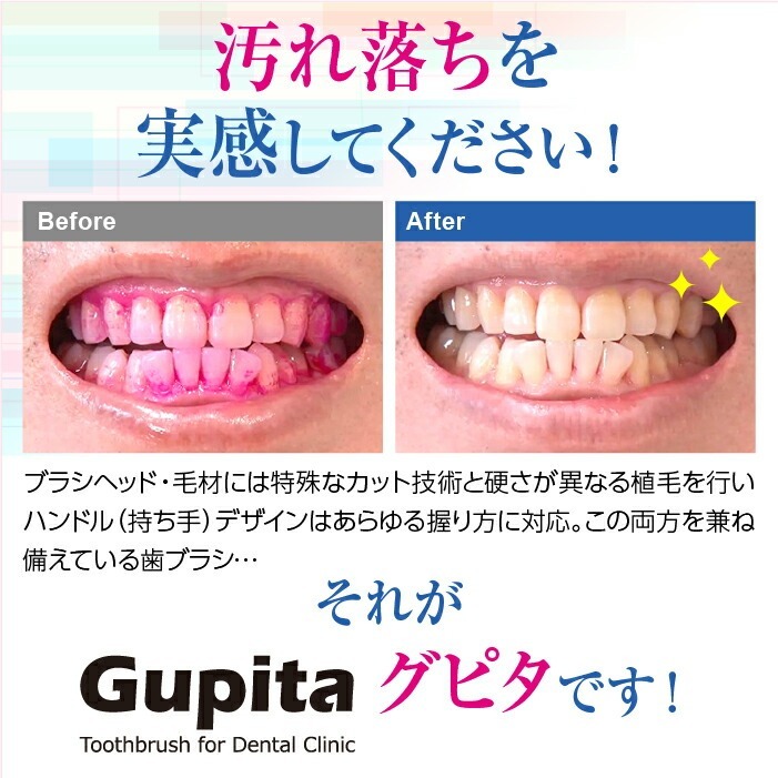 毛のかたさ選べる 歯科専用歯ブラシ Gupita グピタ (毛のかたさ：Mふつう／Sやわらかめ) 20本 (メール便3点まで) 【メール便送料無料】(※日時指定不可)／ 理想の歯ブラシ 全5色 個包装 ／ 復興支援商品 新生活