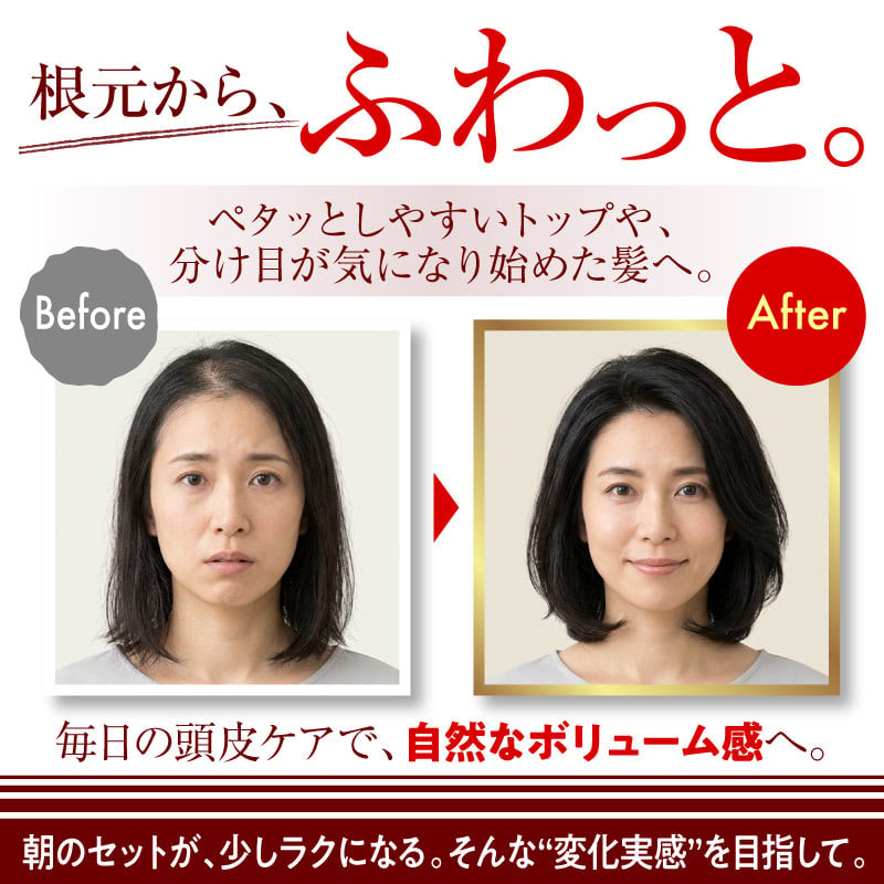 頭皮美容液 スカルピスト ヴァイタルエッセンス / 頭皮美容液 スカルプケア 頭皮ケア ヘアエッセンス ピロリジニルジアミノピリミジンオキシド 配合 ハリ コシ ボリューム感 保湿 頭皮環境 べたつきにくい / 健やかに整える毎日のスカルプ美容液