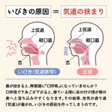 ノン・ノイズ・ノーズ[いびき 鼻呼吸 いびき対策 ノーズクリップ 鼻腔拡張 鼻クリップ いびき防止グッズ 睡眠グッズ ノーズピン 口呼吸対策 快眠グッズ 鼻孔拡張 いびきグッズ 鼻呼吸グッズ 安眠グッズ 鼻腔拡張器 いびきケア]