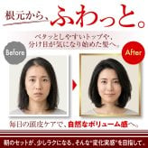 頭皮美容液 スカルピスト ヴァイタルエッセンス / 頭皮美容液 スカルプケア 頭皮ケア ヘアエッセンス ピロリジニルジアミノピリミジンオキシド 配合 ハリ コシ ボリューム感 保湿 頭皮環境 べたつきにくい / 健やかに整える毎日のスカルプ美容液