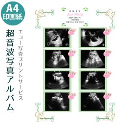 【送料無料】超音波写真アルバム［A4縦］ 赤ちゃんのエコー写真プリントサービス 男の子 女の子 おなかの中の写真・思い出をきれいに保存・保管 出産記念 出産祝い プレゼント ギフ ト贈り物 ベビー マタニティ 妊娠 妊婦 手形 足形