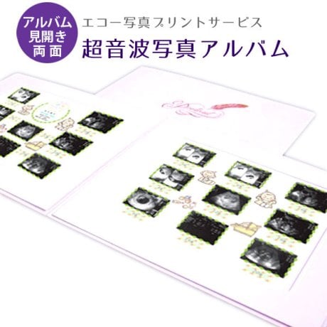 アルバム