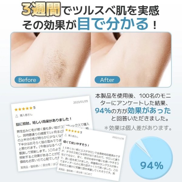 無料ラッピング＆送料無料】サーリシIPL脱毛器 家庭用脱毛器 永久脱毛