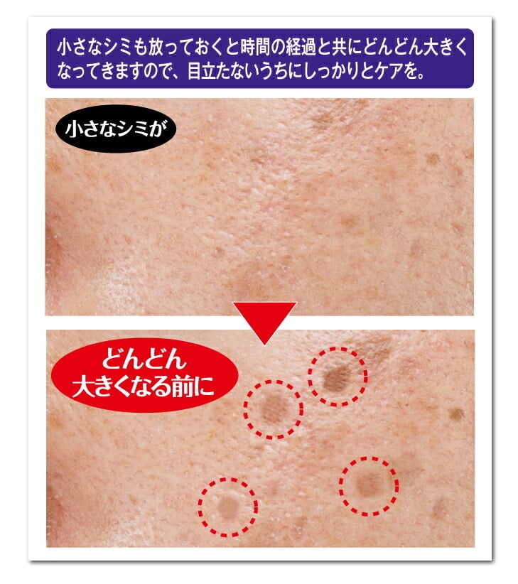 塗ってはがす薬用美白パック】気になるシミにピタッと密着！シミケア