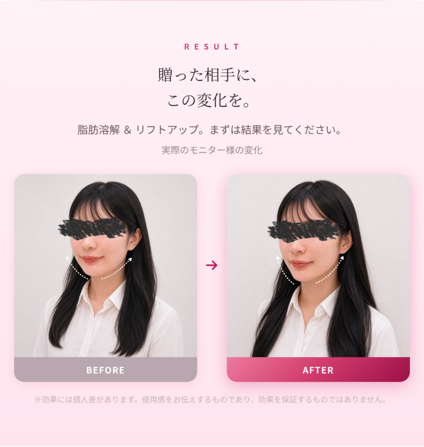 多機能美顔器 S-LAB Pro 6｜EMS エレクトロポレーション LED 6役